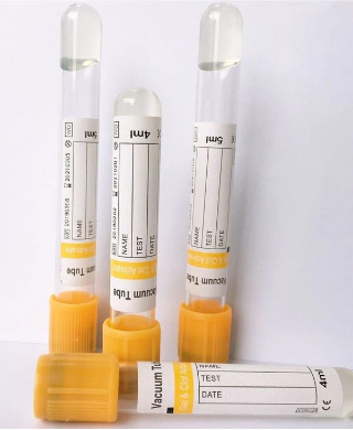 Yellow Cap Blood Tube – 5ML
