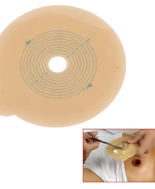 Chinese Colostomy Bas